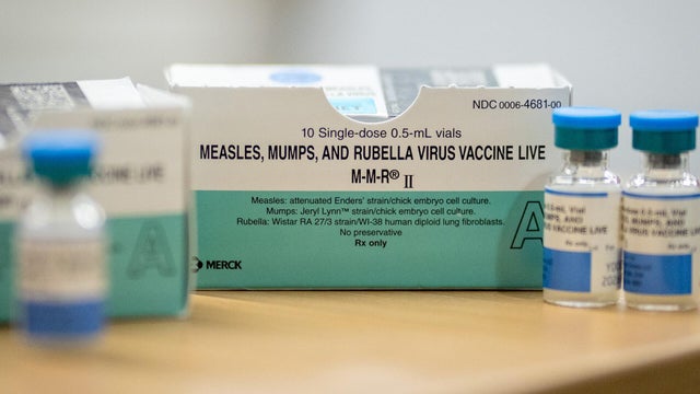 cbsn-fusion-us-measles-outbreak-spreads-to-15-states-thumbnail.jpg 
