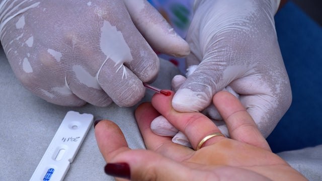 Rapid test for AIDS, syphilis and hepatitis 