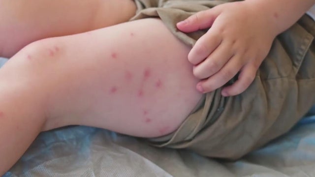 Metro Detroit family who missed airport measles exposure "by hours" speaks out 